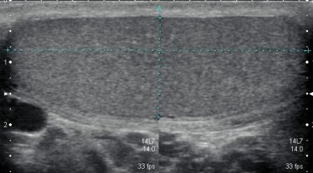 1648005368639275.png y2.png