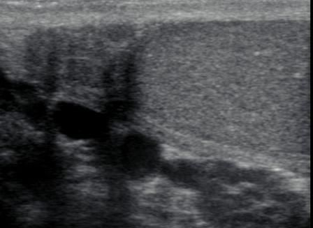 1648005387676690.png y4.png